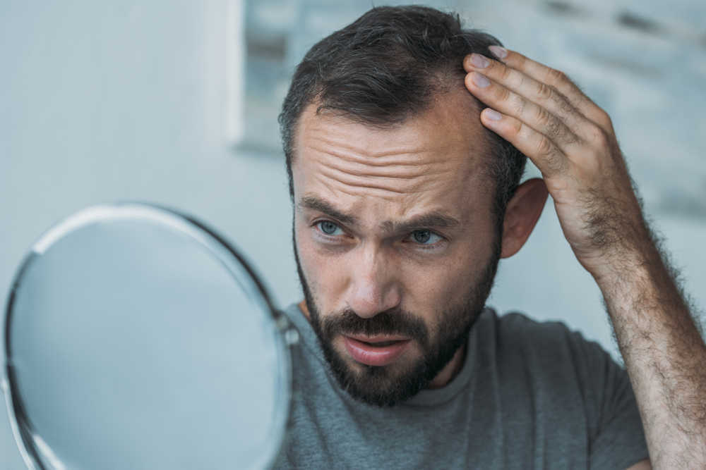 ¿Cómo afecta la alopecia a la psiquis de quien la sufre?